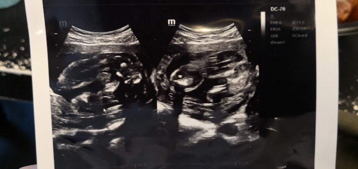 gender reveal 6 months pregnant